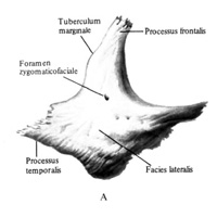 Скуловая кость (os zygomaticum) правая. А - вид снаружи; Б - вид изнутри