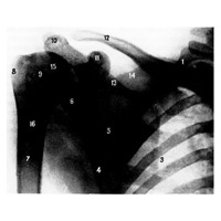 Кости пояса верхней конечности, проксимальный эпифиз плечевой кости и грудная клетка (рентгенограмма)