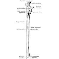 Локтевая кость (ulna) правая; вид со стороны лучевой кости