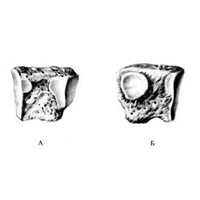 Латеральная клиновидная кость, os cuneiforme laterale, правая