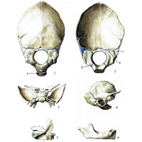 Кости черепа, ossa cranii (новорожденный)