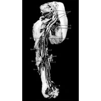 Рис. 1009. Нервы верхней конечности, правой, новорожденного (фотография. Препарат В. Полякова). 1 – шейное и плечевое сплетения; 2 – медиальный и латеральный грудные нервы; 3 – латеральный и медиальный корешки срединного нерва; 4 – локтевой нерв; 5 – срединный нерв; 6 – ветви срединного нерва к поверхностным мышцам; 7 – соединительная ветвь между срединным и локтевым нервами; 8 – соединительная ветвь между локтевым и срединным нервами на кисти; 9 – кожная ветвь лучевого нерва; 10 – передний межкостный нерв предплечья; 11 – плечевая артерия; 12 – мышечно-кожный нерв.