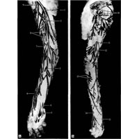 Рис. 1021. Кожные нервы верхней конечности, правой (фотография. Препарат Н. Самойлова). А – ладонная поверхность. Б – тыльная поверхность. 1 – ветви медиального кожного нерва плеча; 2 – медиальный кожный нерв предплечья; 3 – разветвления медиального кожного нерва предплечья; 4 – локтевой нерв; 5 – срединный нерв; 6 – ветви лучевого нерва; 7 – поверхностная ветвь лучевого нерва; 8 – ветви медиального кожного нерва предплечья на плече; 9, 10 – латеральный кожный нерв предплечья; 11 – задний кожный нерв плеча; 12 – задний кожный нерв предплечья; 13 – поверхностная ветвь лучевого нерва; 14 – тыльная ветвь локтевого нерва; 15 – ветви медиального кожного нерва предплечья.