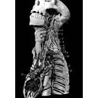 Рис. 1064. Нервы сердца; вид слева (препарат В. Андриеша). 1 – верхний шейный узел; 2 – верхний шейный сердечный нерв; 3 – средний шейный узел; 4 – средний шейный сердечный нерв; 5 – верхняя шейная сердечная ветвь; 6 – шейно-грудной (звездчатый) узел; 7 – нижний шейный сердечный нерв; 8 – блуждающий нерв; 9 – подключичная петля; 10 – грудные узлы; 11 – грудные сердечные нервы; 12 – грудная сердечная ветвь; 13 – связь нервного сплетения легочного ствола с нервными сплетениями кровеносных сосудов и стенок сердца.