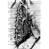 Рис. 1068. Нервы заднего средостения; вид справа (фотография. Препарат К. Березовского). 1 – соединительные ветви между симпатическим стволом и блуждающим нервом; 2 – правый блуждающий нерв; 3 – плечеголовная вена; 4 – легочные ветви; 5 – правое легкое; 6 – бронхиальные ветви; 7 – пищевод; 8 – нервные ветви к перикарду; 9 – пищеводное сплетение; 10 – диафрагмальный нерв; 11 – задний ствол блуждающих нервов; 12 – диафрагма; 13 – малый внутренностный нерв; 14 – большой внутренностный нерв; 15 – ветви симпатического ствола к сплетению грудного протока; 16 – грудная аорта; 17 – ветви нервного сплетения грудного протока; 18 – грудной проток; 19 – ветви симпатического ствола к сплетению непарной вены; 20 – непарная вена; 21 – соединительные ветви; 22 – соединительные ветви к пищеводному сплетению; 23 – коллатеральный ствол; 24 – нижний сердечный нерв; 25 – шейно-грудной (звездчатый) узел; 26 – подключичная петля; 27 – средний шейный узел симпатического ствола.