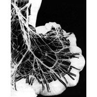 Рис. 1084. Нервное сплетение сигмовидной кишки (фотография. Препарат Е. Мельмана). (Сигмовидная кишка растянута.)