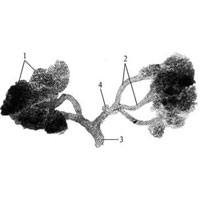 Рис. 1135. Изолированная железа слизистой оболочки слуховой трубы (фотография. Препарат Д. Розенгауза).