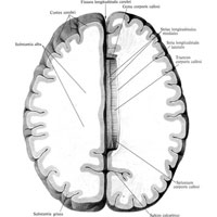 Рис. 907. Полушария большого мозга, hemispherii cerebrales, и мозолистое тело, corpus callosum; вид сверху. (Полушария мозга частично удалены; в правом полушарии вырезана часть белого вещества и видно мозолистое тело.)
