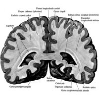 Рис. 909. Большой мозг, cerebrum; вид сзади. (Фронтальный разрез на уровне утолщения мозолистого тела.)