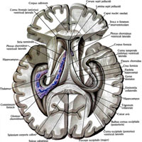 Рис. 910. Боковые желудочки, ventriculi laterales; вид сверху. (Ствол мозолистого тела удален; вскрыты передний, задний и нижний рога и центральная часть боковых желудочков.)