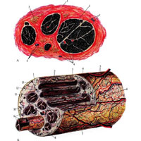 Рис. 966. Строение периферического нерва (схема) (по Д. Сигалевичу). (Создана на основании макромикроскопического изучения нервов и сосудов тотальных участков оболочек нервных стволов, обработанных методом импрегнации нитратом серебра.) А – поперечное сечение периферического нерва: 1 – эпиневрий; 2 – периневрий; 3 – эндоневрий; 4 – сосуды в оболочках нерва; 5 – жировая ткань. Б – иннервация и кровоснабжение периферического нерва: 1 – эпиневрий; 2 – внутреннее эпиневральное сосудисто-нервное сплетение; 3 – перииеврий; 4 – эндоневрий; 5 – наружное эпиневральное сосудисто-нервное сплетение; 6 – пластинчатые тельца в эпиневрии; 7 – околопучковое сосудисто-нервное сплетение; 8 – периневральное сосудисто-нервное сплетение; 9 – эндоневральное сосудисто-нервное сплетение; 10 – миелиновые нервные волокна; 11 – сосуды и нервы, проникающие в периневрий и эндоневрий; 12 – отделение нервного волокна от пучка к оболочкам нервного ствола; 13 – пластинчатое тельце в периневрии.