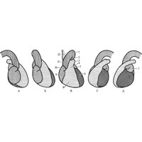 Рис. 700. Рентгеновское изображение сердца и крупных сосудов в различных проекциях (схема). А—правая боковая проекция. Б — правая переднекосая проекция. В—передняя проекция. Г — левая передне-боковая проекция. Д — левая боковая проекция. 1 — дуга аорты; 2 — нисходящая часть аорты; 3—легочный ствол; 4 — аортальный конус; 5—левое ушко; 6 — левый желудочек; 7—левое предсердие; 8—правый желудочек; 9—правое предсердие; 10 — правое ушко; 11—восходящая часть аорты; 12 — верхняя полая вена.