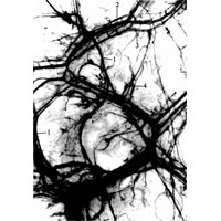 Рис. 726. Нервы и сосуды левой боковой стенки перикарда (препарат Л. Торубаровой). (Участок тотально окрашенного препарата перикарда ребенка 1,5 лет.) 1 — нервные стволы; 2 — артерии; 3 — вены; 4 — нервные окончания.