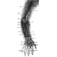 Рис. 753. Артерии правой верхней конечности новорожденного (фотография рентгенограммы). (Рука в положении пронации.) 1 — плечевая артерия; 2 — задняя артерия, огибающая плечевую кость; 3 — плечевая кость; 4 — лучевая возвратная артерия; 5 — лучевая кость; 6 — лучевая артерия; 7 — ладонная сеть запястья; 8 — артерия большого пальца кисти; 9 — общие ладонные пальцевые артерии; 10, 11 — собственные ладонные пальцевые артерии; 12 — поверхностная ладонная дуга; 13 — глубокая ладонная дуга; 14 — задняя межкостная артерия; 15 — локтевая артерия; 16 — локтевая кость; 17 — передняя ветвь возвратной локтевой артерии; 18 — задняя ветвь возвратной локтевой артерии; 19 — сеть локтевого сустава; 20 — нижняя локтевая коллатеральная артерия; 21 — глубокая артерия плеча.