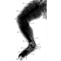 Рис. 786. Артерии правой нижней конечности новорожденного (фотография рентгенограммы).
