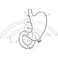 Рис. 502. Топография желудка и двенадцатиперстной кишки (скелетотопия). 1 – желудок; 2 – двенадцатиперстная кишка; 3 – XII ребро.