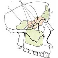 Рис. 557. Околоносовые пазухи (схема). 1 – sinus frontalis; 2 – sinus maxillaris; 3 – sinus sphenoidalis; 4 – sinus ethmoidalis. 