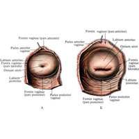 Рис. 654. Влагалищная часть шейки матки, portio vaginalis cervicis uteri; вид снизу. A – нерожавшей женщины; Б – рожавшей женщины.